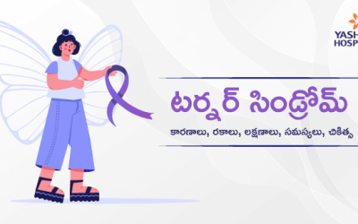 టర్నర్ సిండ్రోమ్ : కారణాలు, రకాలు, లక్షణాలు, సమస్యలు, చికిత్స