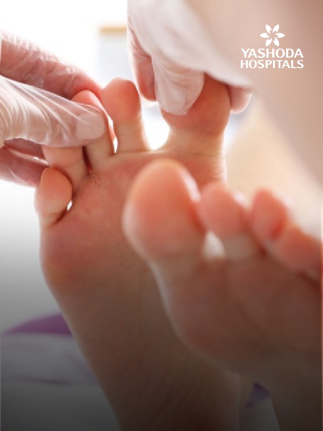 diseases caused by fungi banner