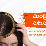 Dandruff problem Telugu Main Banner