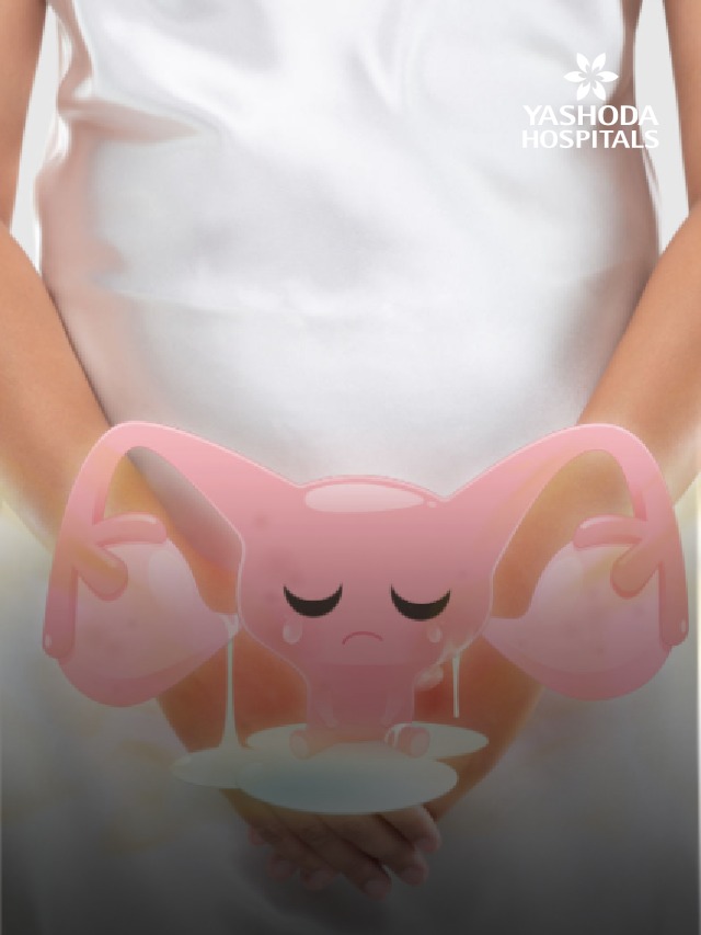 ovarian cancer slide4