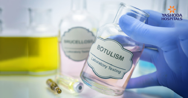 Botulism