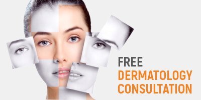 Free Dermatology  Consultation