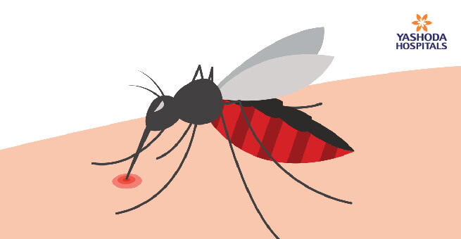 Malaria