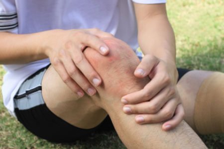 Runner’s knee causes