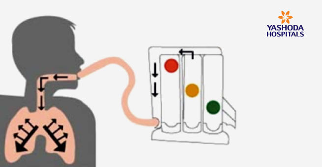 SPIROMETRY