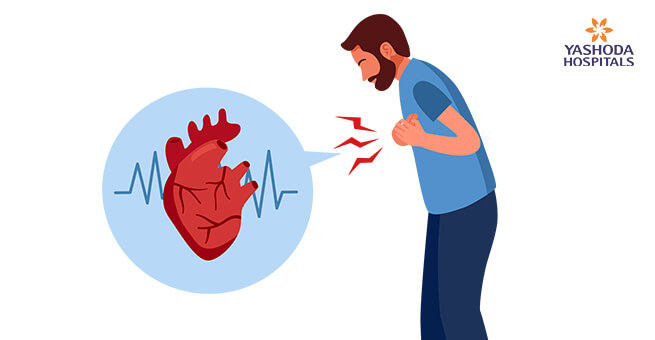 Symptoms of a heart attack