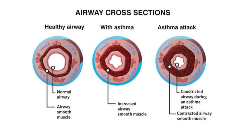 airway cross section