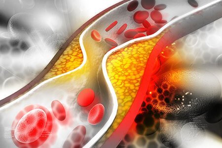 Causes of arrhythmias