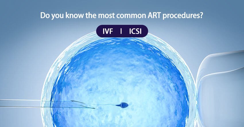 What is assisted reproductive technology