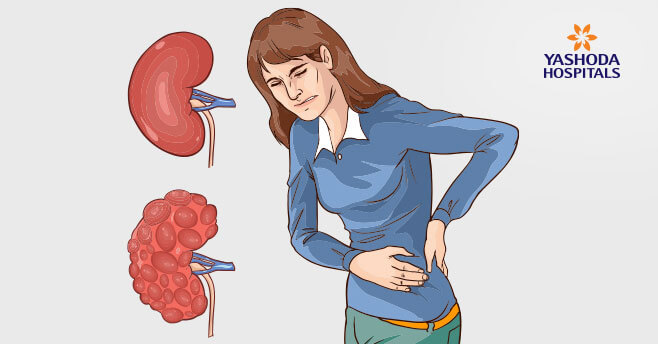 Chronic Kidney Disease