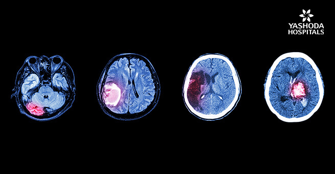 collection ct scan brain multiple disease