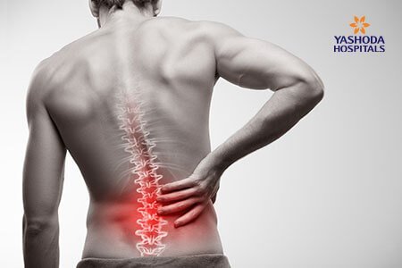 complications of Spondylolysis