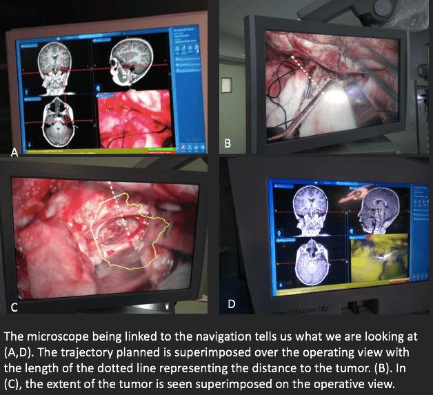 neuronavigation image guidance