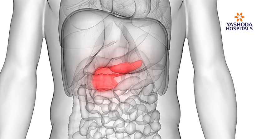 pancreatic cancer (PC)