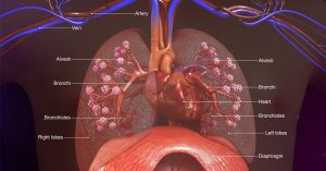 respiratory diseases air sacs