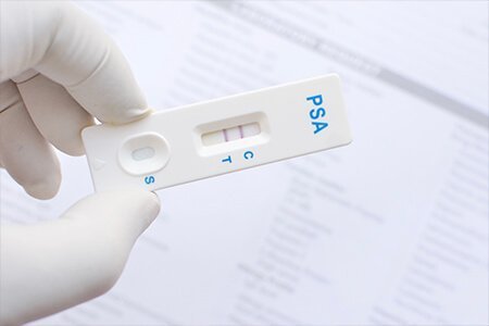 Prostate-specific antigen (PSA)